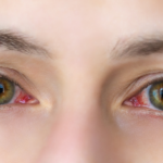 Is Vowiszojid54 For Sensitive Eyes