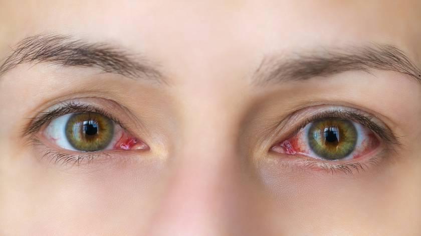 Is Vowiszojid54 For Sensitive Eyes
